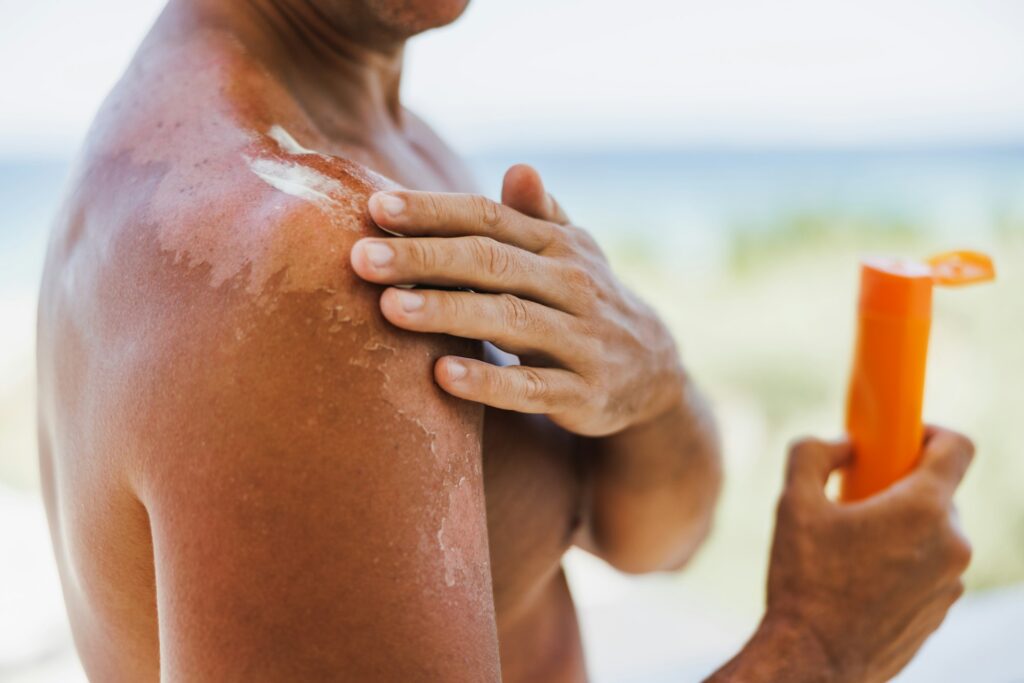 Tanning Lotion Rash Allergic Reaction To Sun Tan Lotion? Here’s What To Do – Tanning Lotion ...